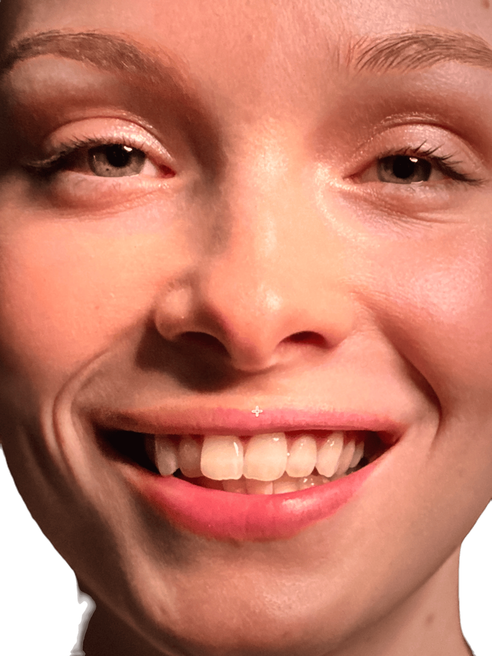 Vorher