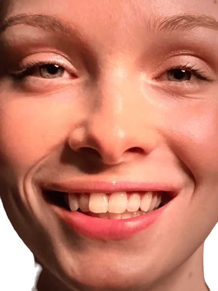 Vorher